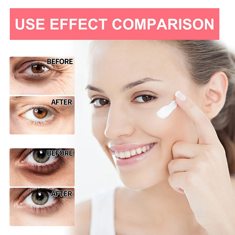 Retinol Eye Cream Stick